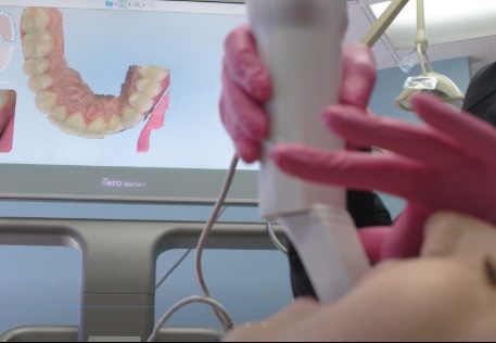 Dentist using itero intraoral scanner to capture digital impressions