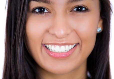 Woman with flawless smile after cosmetic dentistry