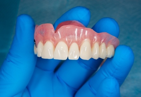 Hand holding a denture restoration