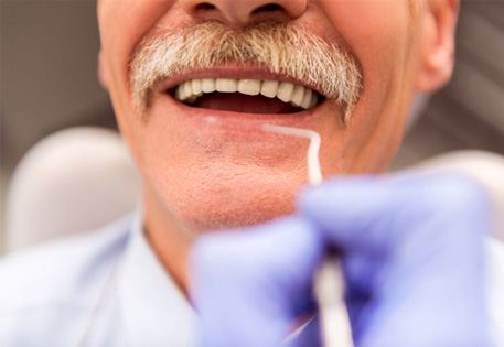 Man with dentures in Dallas 