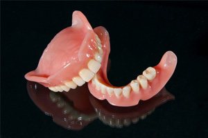 Full dentures in Dallas