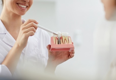 Dentist giving the answers to dental implant frequently asked questions