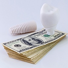 Dental implant in Dallas and crown resting on money
