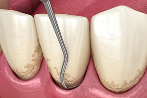 Illustration of scaling process?