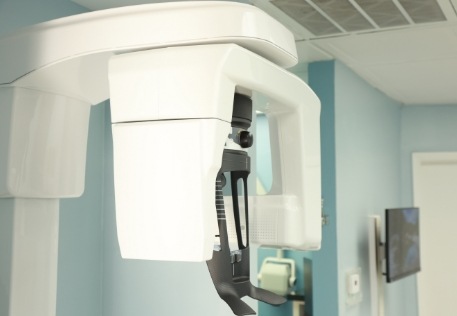 2 D C T cone beam digital x-ray scanner