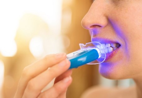 Dental patient using take home teeth whitening kit