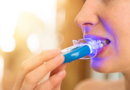 Dental patient using take home teeth whitening kit