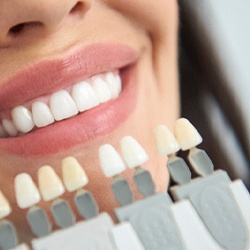 Dallas cosmetic dentist checking shade of patient's teeth