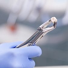 Metal clasp holding extracted tooth