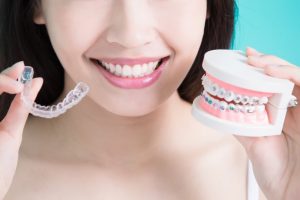 Invisalign and braces