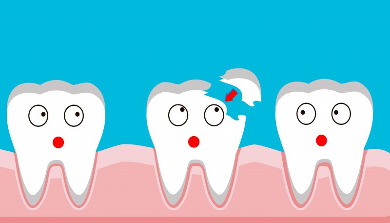 Chipped tooth illustration