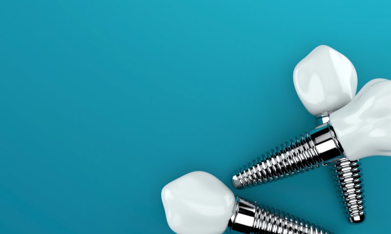 A close-up of dental implants in Dallas