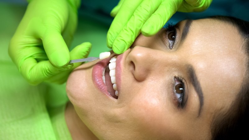 Woman getting veneers