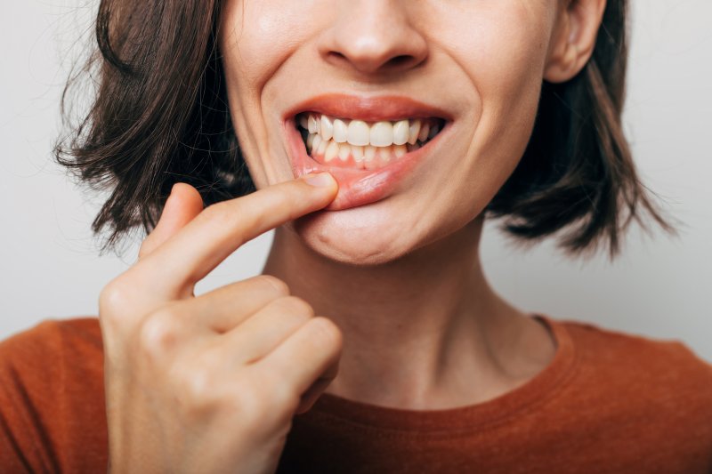 Lady inspects gums