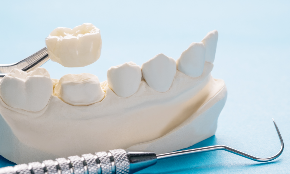 Model dental crown