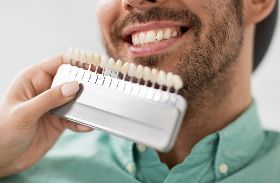 Man holding teeth whitening shade model up to smile