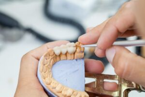 Artisan sculpting a dental bridge